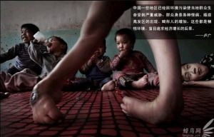 山西省是全国污染最严重的地区，也是缺陷婴儿出生率最高的省份，这是一对爱心的农妇领养17名残疾孩子2009年4月15日
