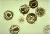 艾滋病病毒亚显微图片